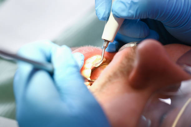 Best Urgent Care for Lost Fillings or Crowns in Berea, SC
