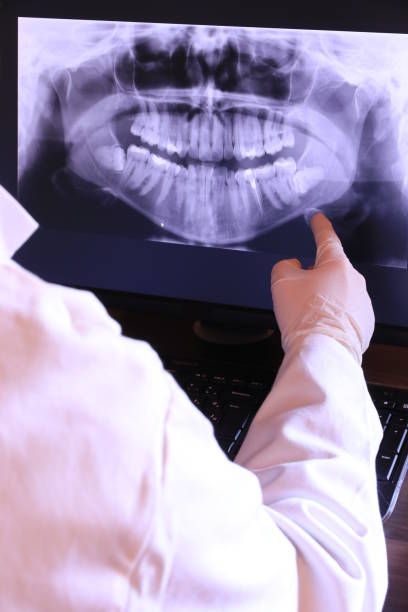Best Emergency Dental Care for Broken or Chipped Teeth in Berea, SC